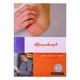 Psoriasis Disease (Dr Khin Mg Lwin)